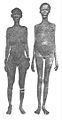 Khoikhoi women with enlarged labia