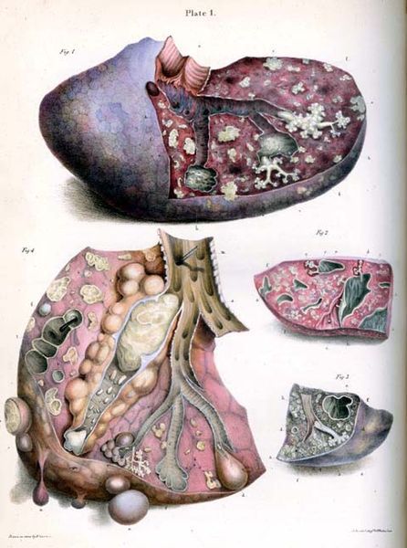 File:Carswell-Tubercle.jpg