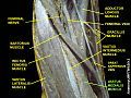 Vastus medialis muscle