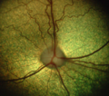 Image 1The dog's retina shows the optic disc and the eye's vasculature. (from Dog anatomy)