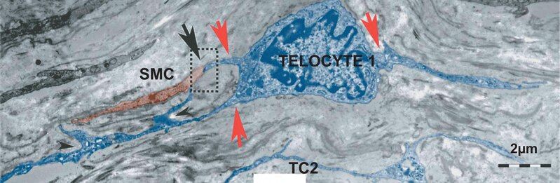 File:Telocytes-Fig 5.tif