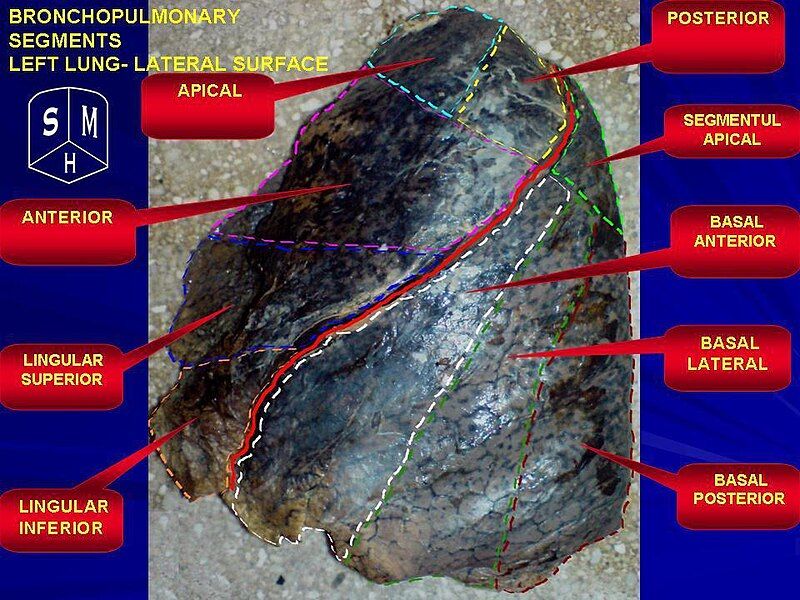 File:Human left lung.jpg