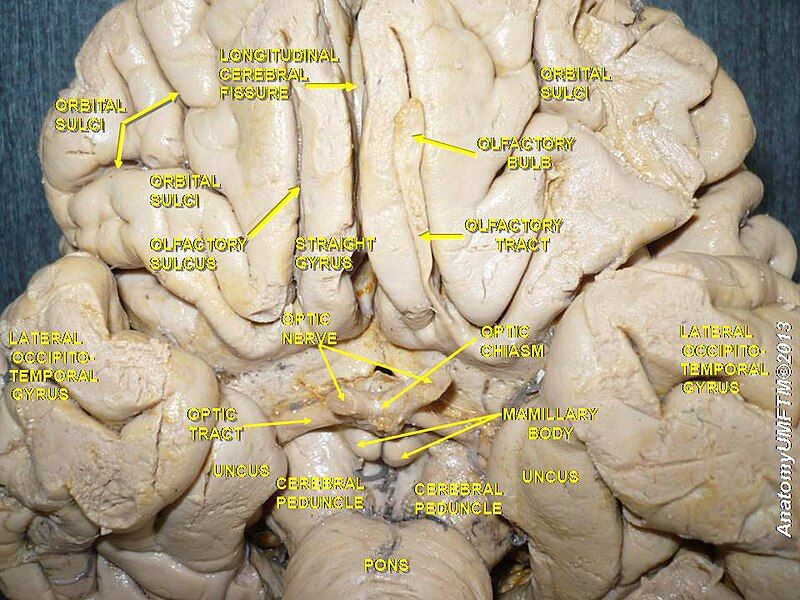 File:Slide21ior.JPG