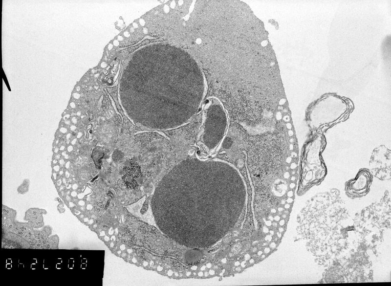 File:Apoptosis.jpg