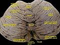 Cerebellum. Superior surface.