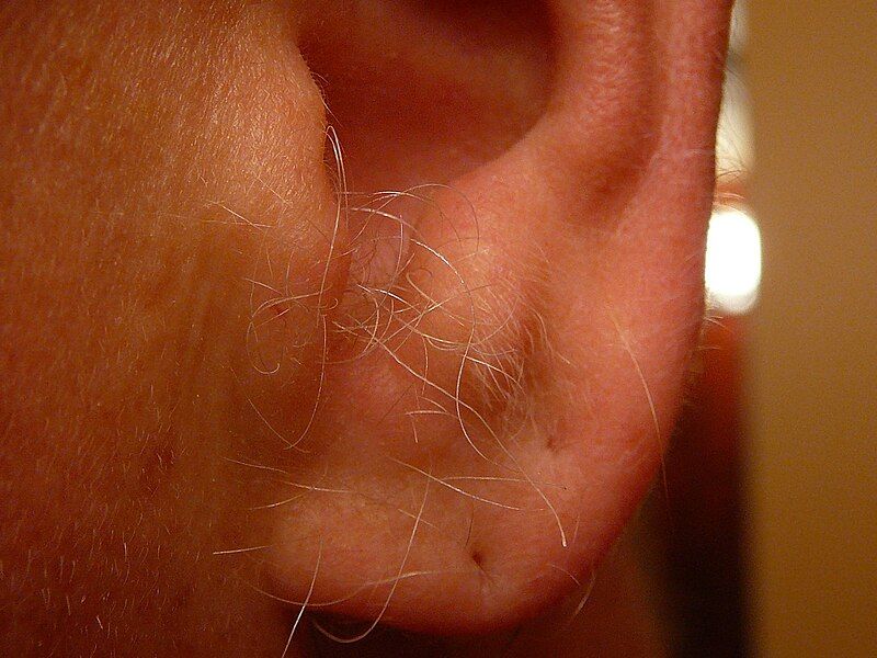 File:Ear hair.jpg