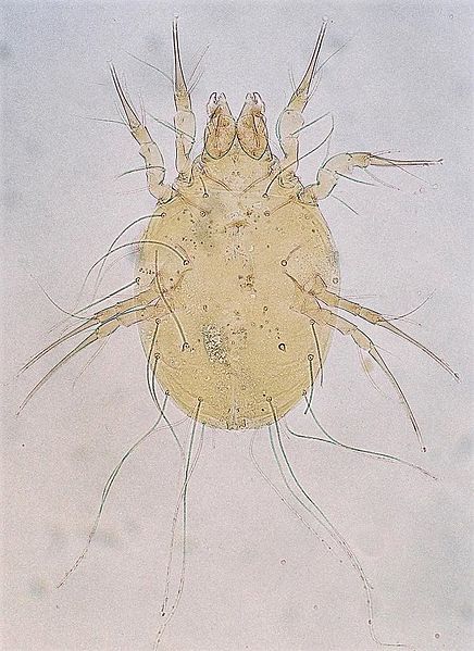 File:Glycyphagus-spp-mite.jpg