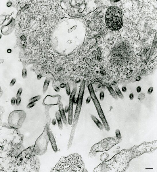 File:Sweetwater branch virus.jpg