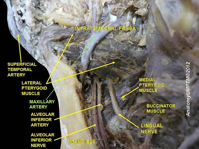 File:Slide7dddd.JPG