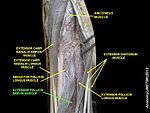 Extensor pollicis brevis muscle