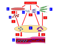 This model is a representation of the process of Diabetic Ketoacidosis. A: Muscle Fiber B: Amino Acids C: Liver E: Fatty Acids F: Glucagon G: Blood Vessel 1. Lack of insulin leads to the release of amino acids from the muscle fiber. 2. Amino acids are released from the muscle fiber, which get converted into glucose inside of the liver. 3. The Glucose produced becomes abundant in the bloodstream. 4. Fatty Acids and Glycerol are released from the adipose tissue, which get converted into ketones inside of the liver. 5. Along with the Fatty Acids and Glycerol, the Glucose produced from the lack of insulin also gets converted into ketones inside of the liver. 6. The ketones produced become abundant in the bloodstream. This leads to high blood sugar levels, nausea, vomiting, thirst, excessive urine production, and abdominal pain. Partially derived from: http://en.wikipedia.org/wiki/Glucagon