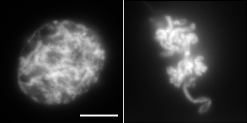 File:Nucleus-chromosomes.png