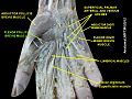 Flexor pollicis brevis muscle