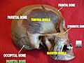 Parietal bone