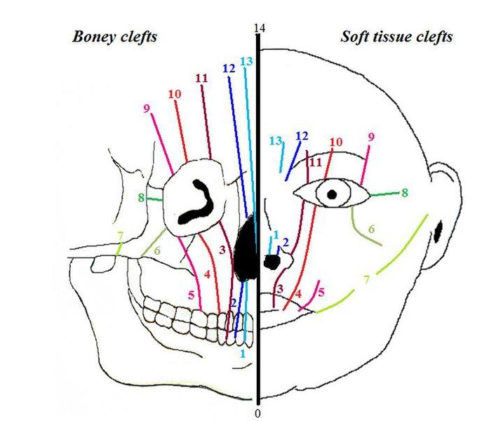 File:Picture Tessier classification.jpg