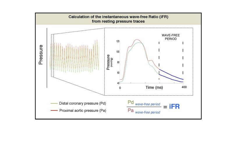 File:IFR calculation.pdf