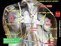 Testicular artery and vein