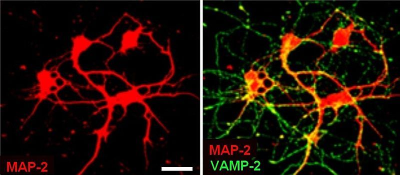 File:Hippocampal neurons.jpg