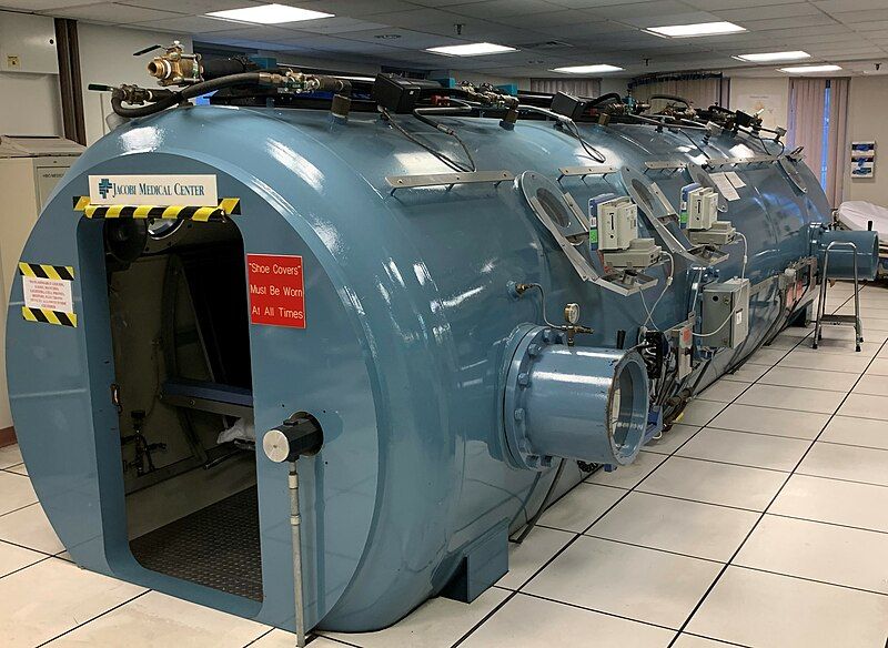 File:Jacobi Hyperbaric Chamber.jpg