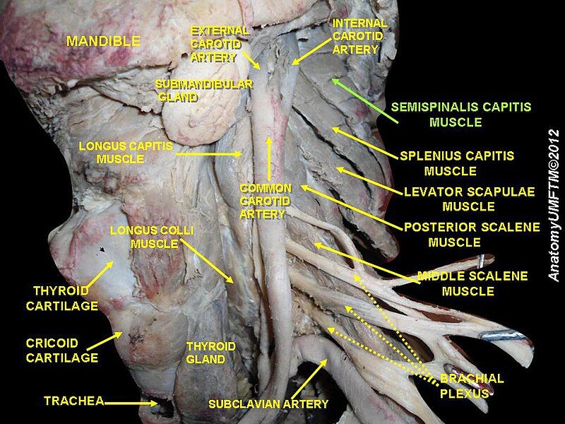 File:Slide1ccc.JPG