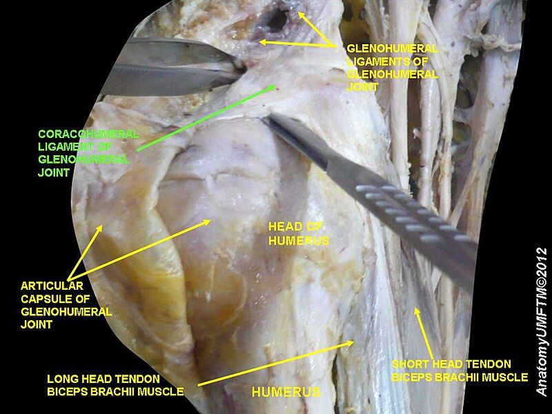 File:Slide1KKKK.JPG