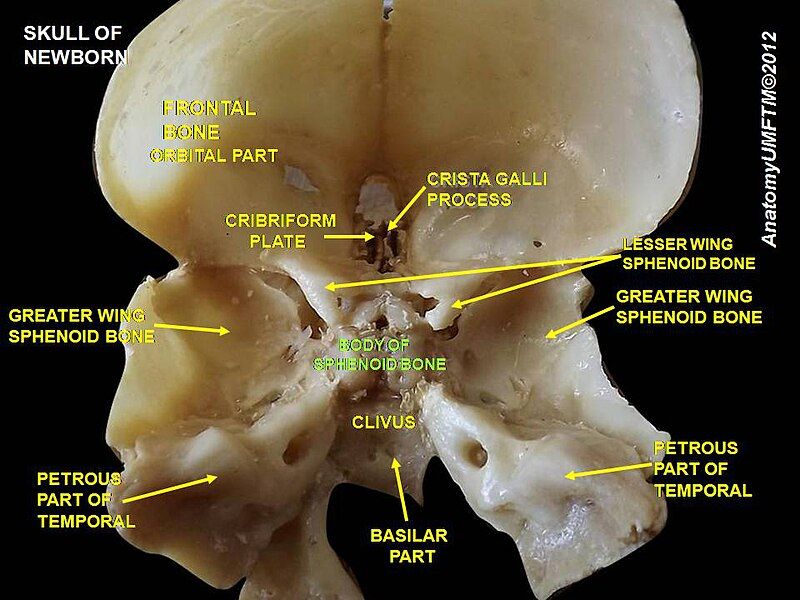 File:Slide5pppp.JPG