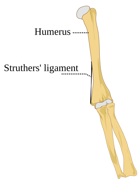 File:Struthers' ligament.svg