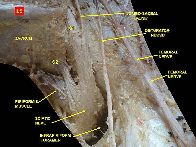 File:Slide4erer.JPG