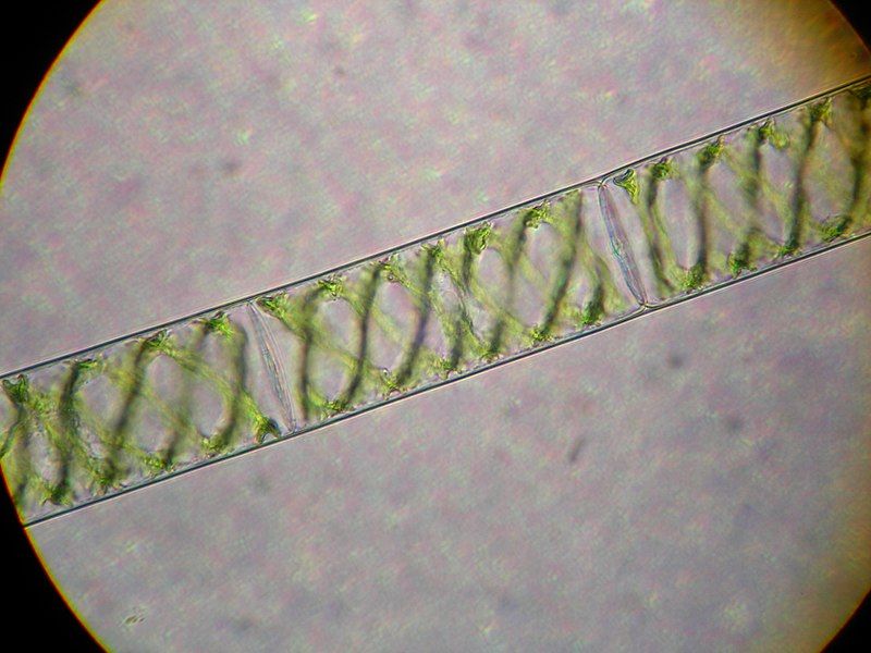 File:Spirogyra.JPG