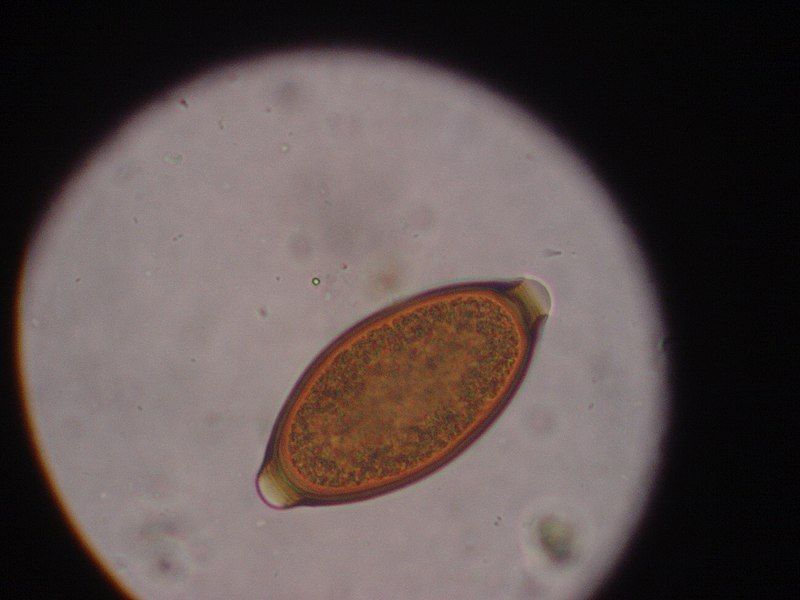 File:Whipworm egg.JPG