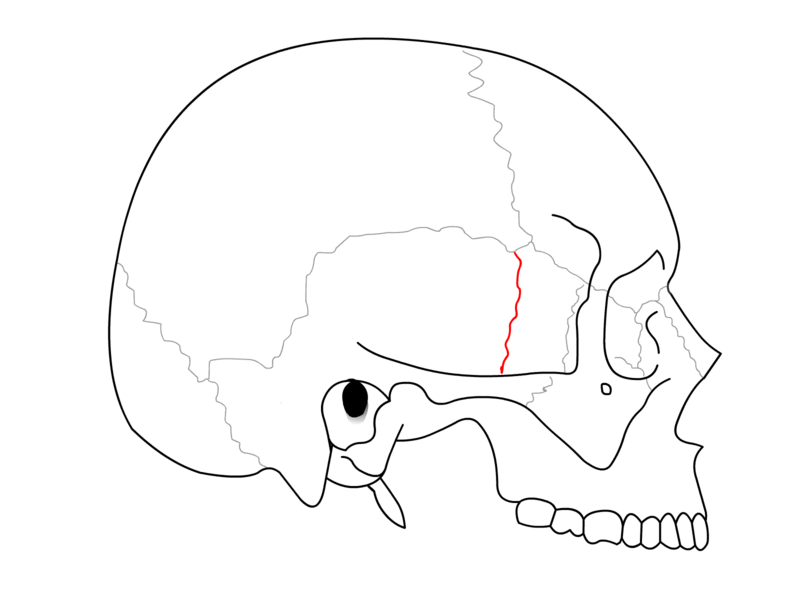 File:SchaedelSeitlichSutur10.png