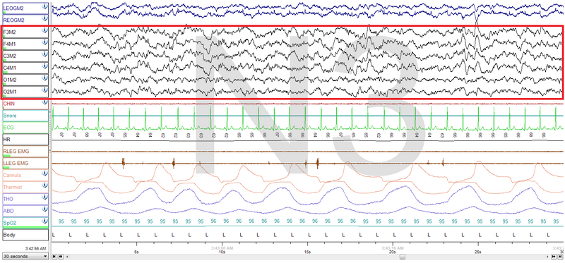 File:N3Sleep.png