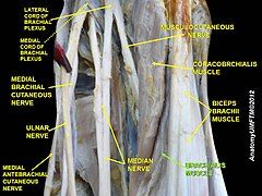 Brachialis muscle (labeled in green text)