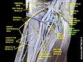 Medial circumflex femoral artery