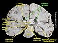 Choroid plexus