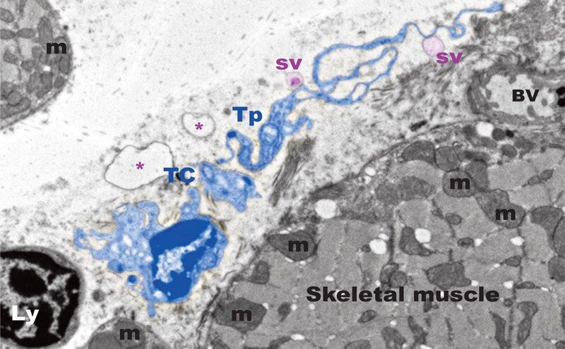 File:Telocytes-Fig 16.tif