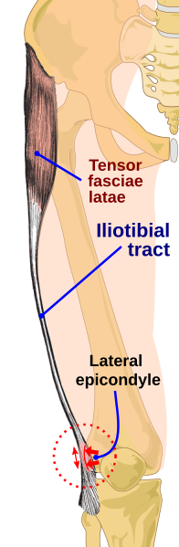 File:Iliotibial band syndrome-en.svg