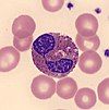 Eosinophil