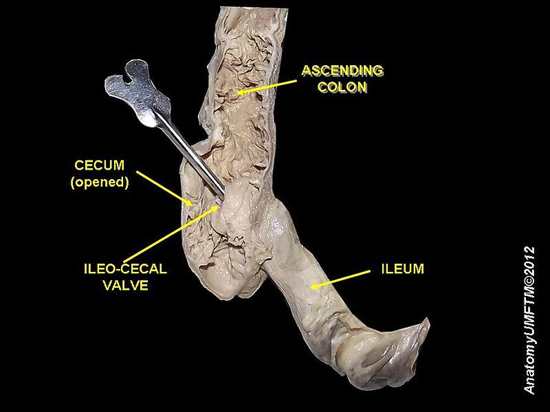 File:Cecum and ileum.JPG