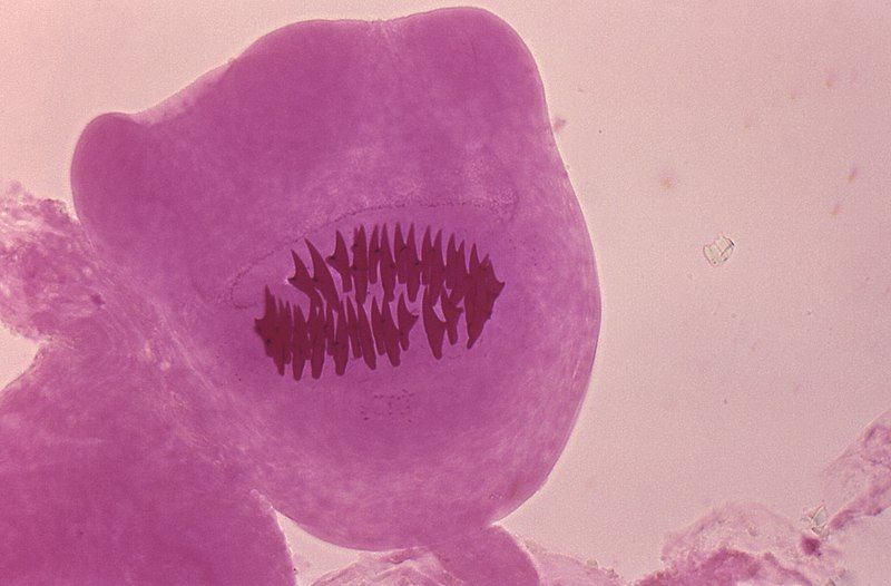 File:Echinococcus vogeli.jpg