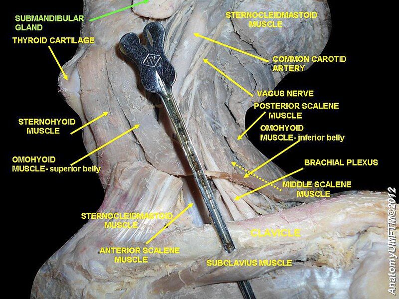 File:Slide1b.JPG