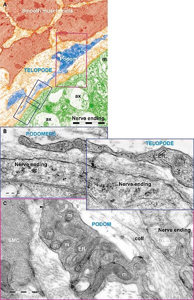 File:TC jejunum 3.jpg