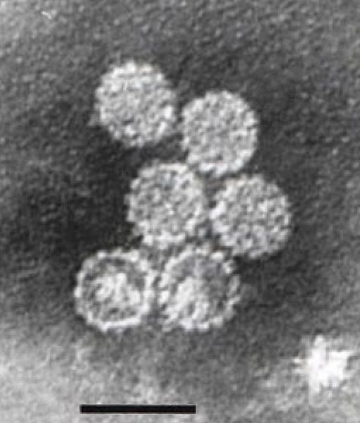 File:Papillomavirus.jpg