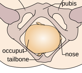 File:Cephalic presentation.svg