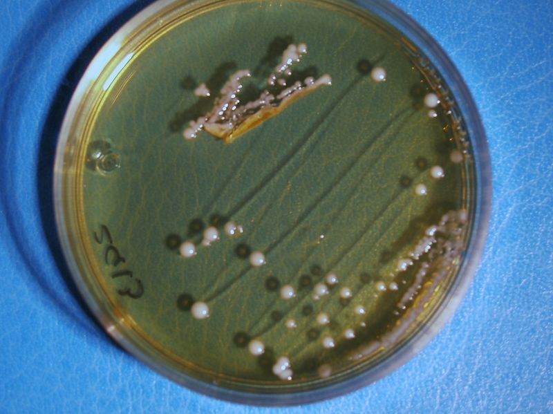 File:Lactobacillus spp..JPG