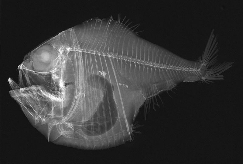 File:Argyropelecus lychnus X-ray.jpg