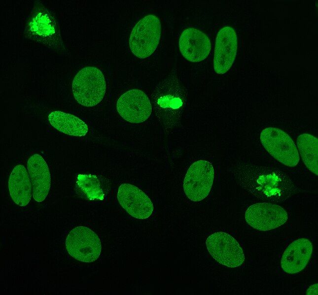 File:DsDNA antibodies.jpg