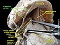 Submental artery