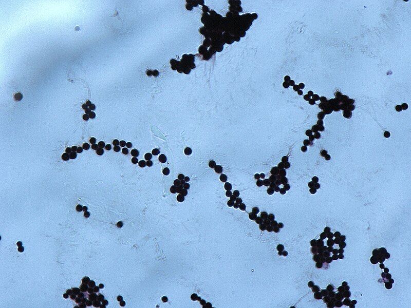 File:Cryptococcus Gram film.jpg