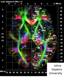 Image shows colored picture demonstrating orientations of fibers based on principle eigenvectors and eigenvalues of DTI matrices.